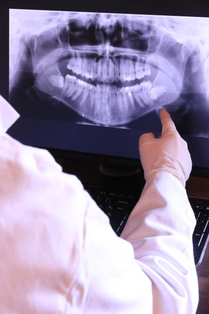 Best Dental Abscess Treatment in Port Washington, WI