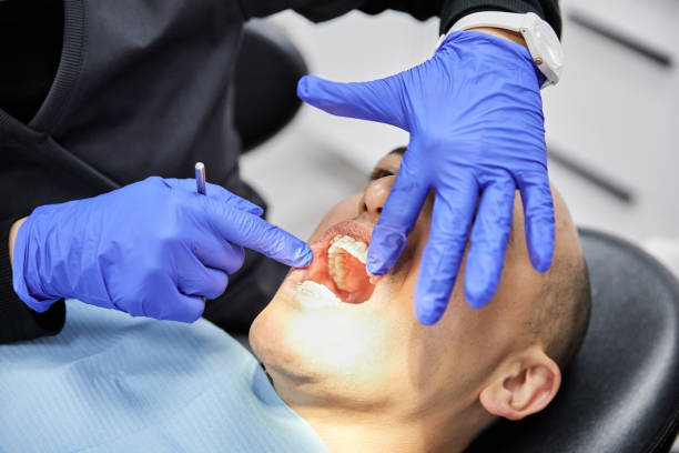 Best Emergency Wisdom Tooth Extraction in Port Washington, WI